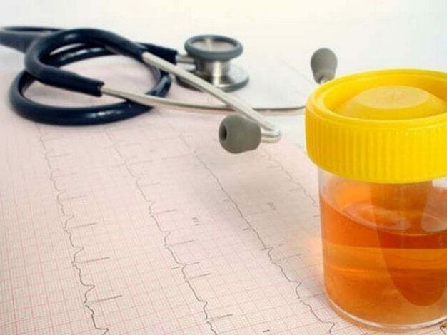 Urinanalyse zur Diagnose einer Blasenentzündung